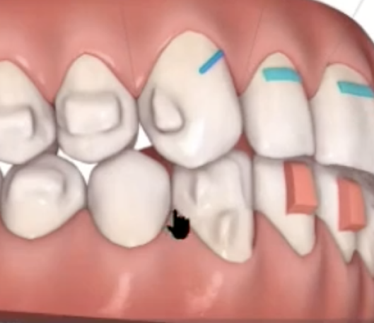 Compare and contrast