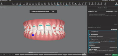 You can now digitally verify full-arch scans with Nexus Connect! The first  A.I enabled implant-scan alignment software. Full-arch scans…
