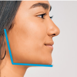 image-large-card-women-showing-jawline
