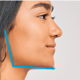 image-large-card-women-showing-jawline- first image