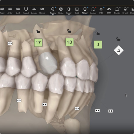 Auto-generated 3D model of roots, crowns and bones patients