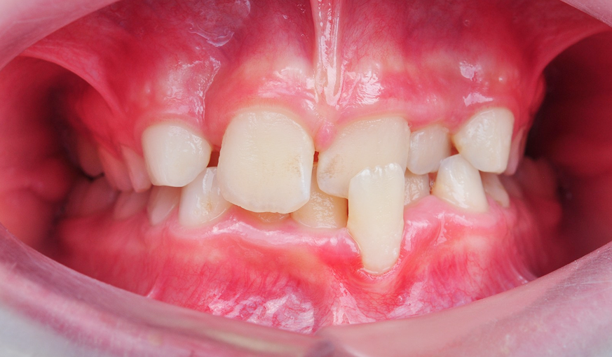 before image