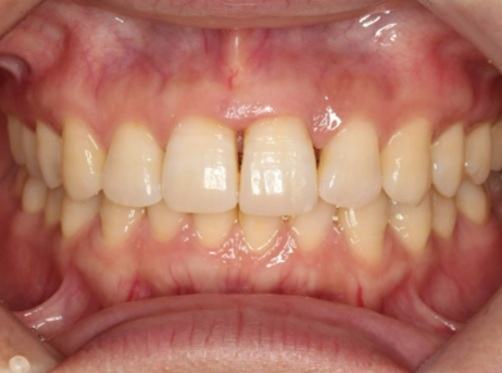 after image