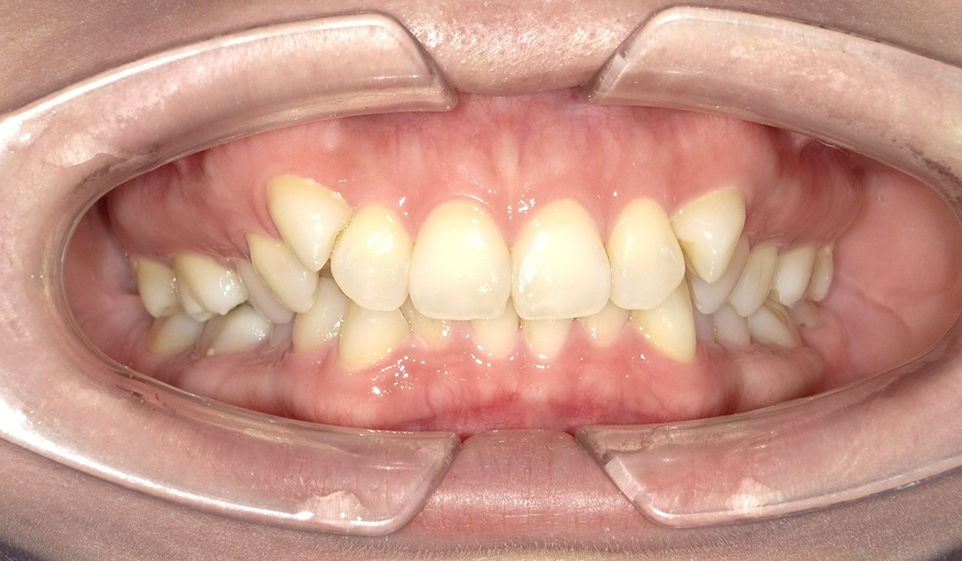 before image