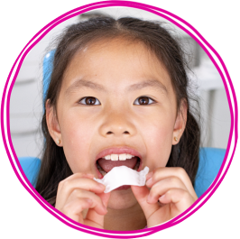 Mała dziewczynka wkłada swój ekspander podniebienny Invisalign®