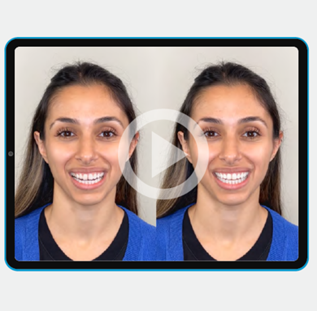 For General Dentists | Invisalign Provider