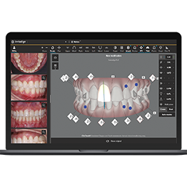 image-card-laptop-treatable-cases