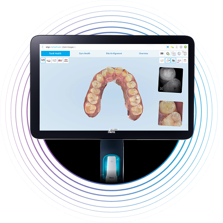 tooth-health-monitor-image