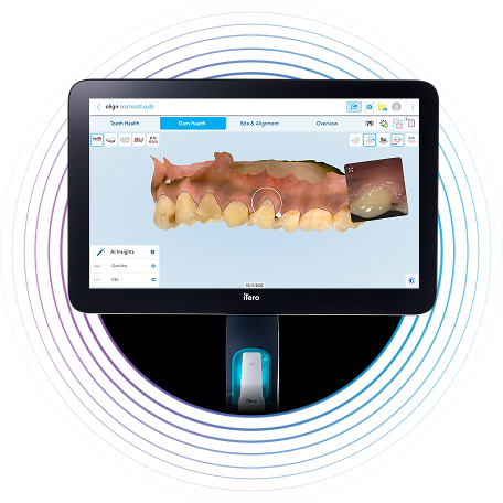 gum-health-new-monitor-image