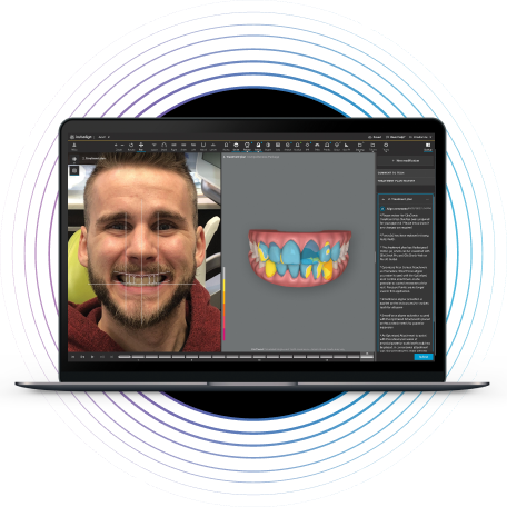 Outil Invisalign Smile Architect™  [NOUVEAUTÉ]