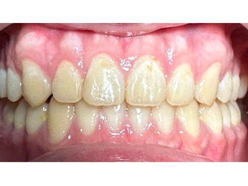 after image