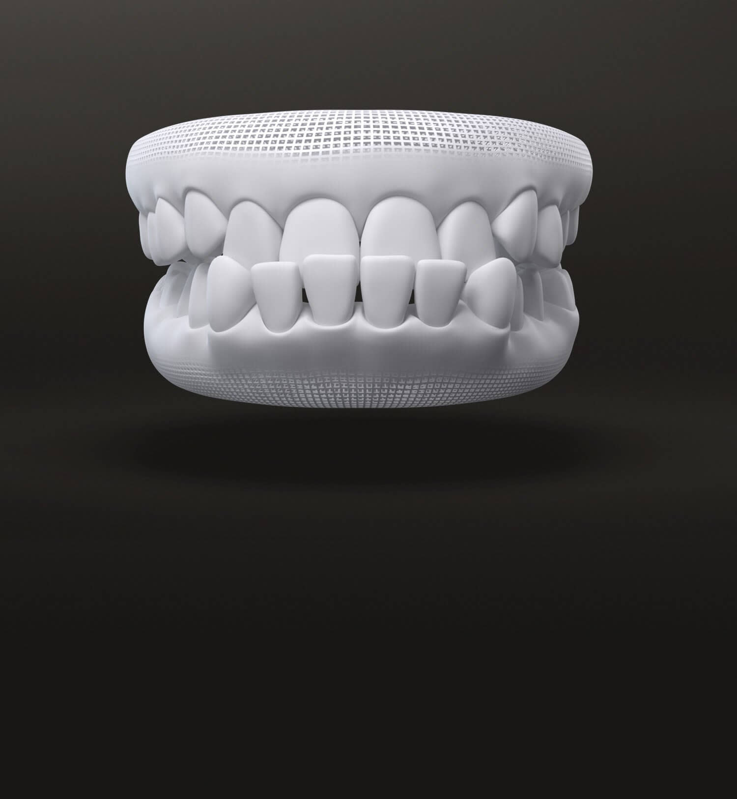 Morso inverso modello 3D - Allineatori dentali trasparenti - Invisalign Italia
