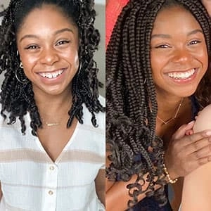 Young woman testimonial before and after treatment with Invisalign® clear aligners