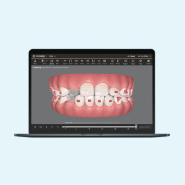 image-large-card-clincheck-sigature-expierence