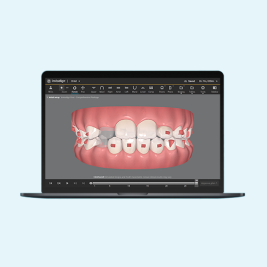 image-large-card-clincheck-sigature-expierence