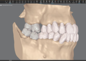 Roots with bone view on CBCT integration