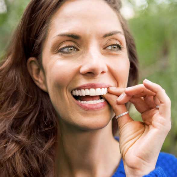 Mulher colocando um alinhador transparente Invisalign