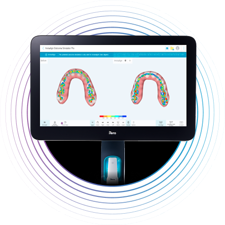 occlusogram-image-monitor
