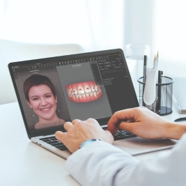 Clincheck® software showing a woman and her tooth movement with Invisalign treatment