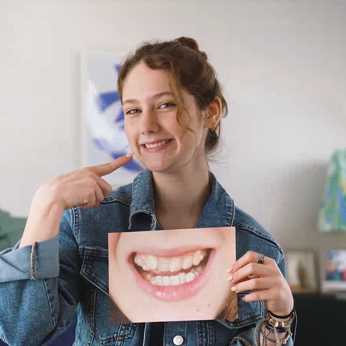 فتاة تبتسم وتشير إلى أسنانها بعد علاج Invisalign® وهي تحمل صورة لأسنانها قبل العلاج
