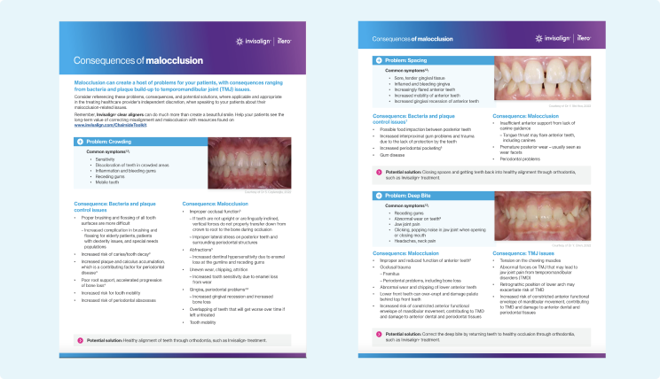 image-tab-conseq-of-malocclusion