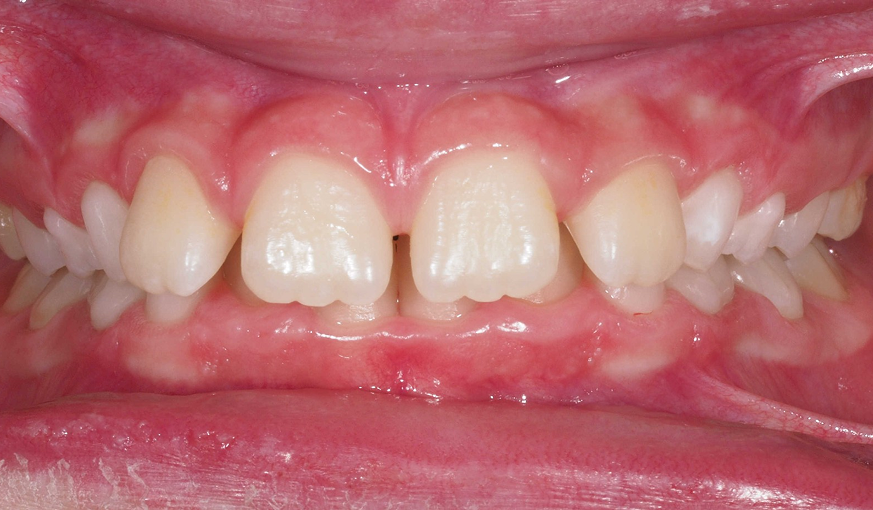 before image