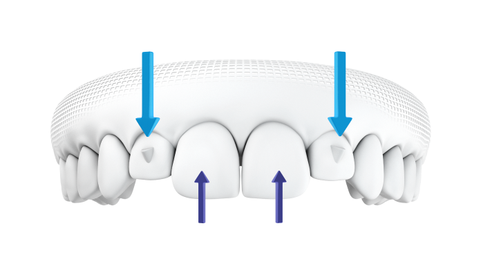 SmartForce attachments