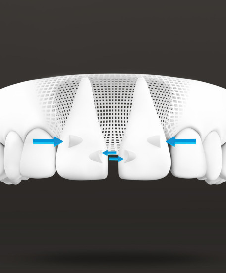 image-accordion-smartforce-attachments