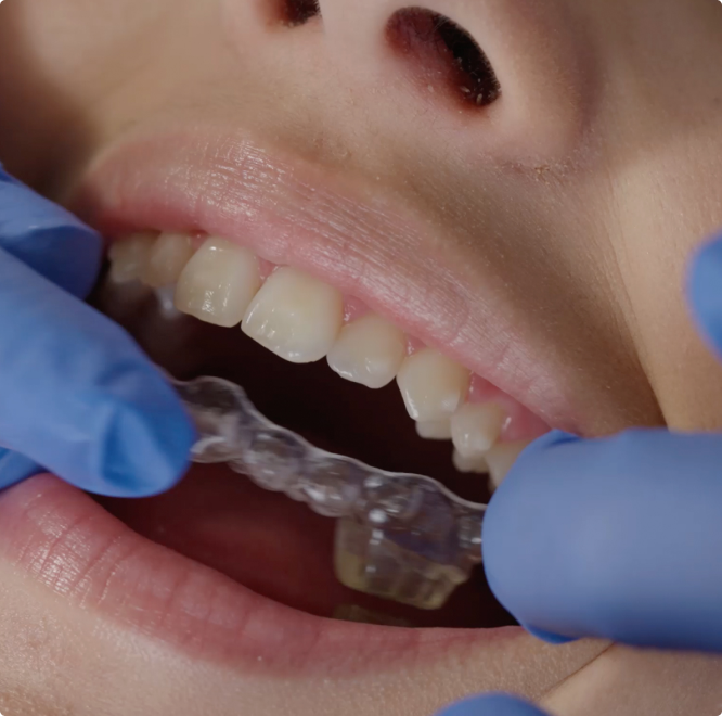 Mask group maob hero slide three