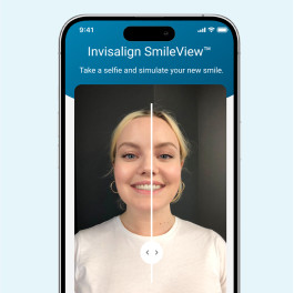 Invisalign Smileview technology on My Invisalign app