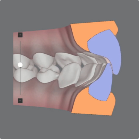 image-text-media-q4-cc-software-update-bundle