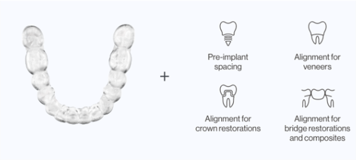 Why Clear Aligners? | Invisalign Provider