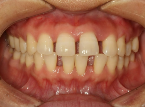 before image