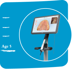 image-card-age-5-itero-lumina-scanner