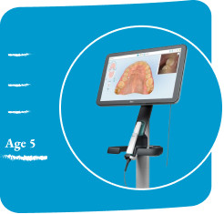 image-card-age-5-itero-lumina-scanner