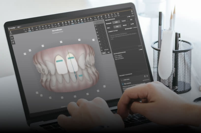 ClinCheck 6.0