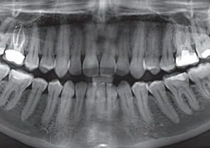 case REPORT