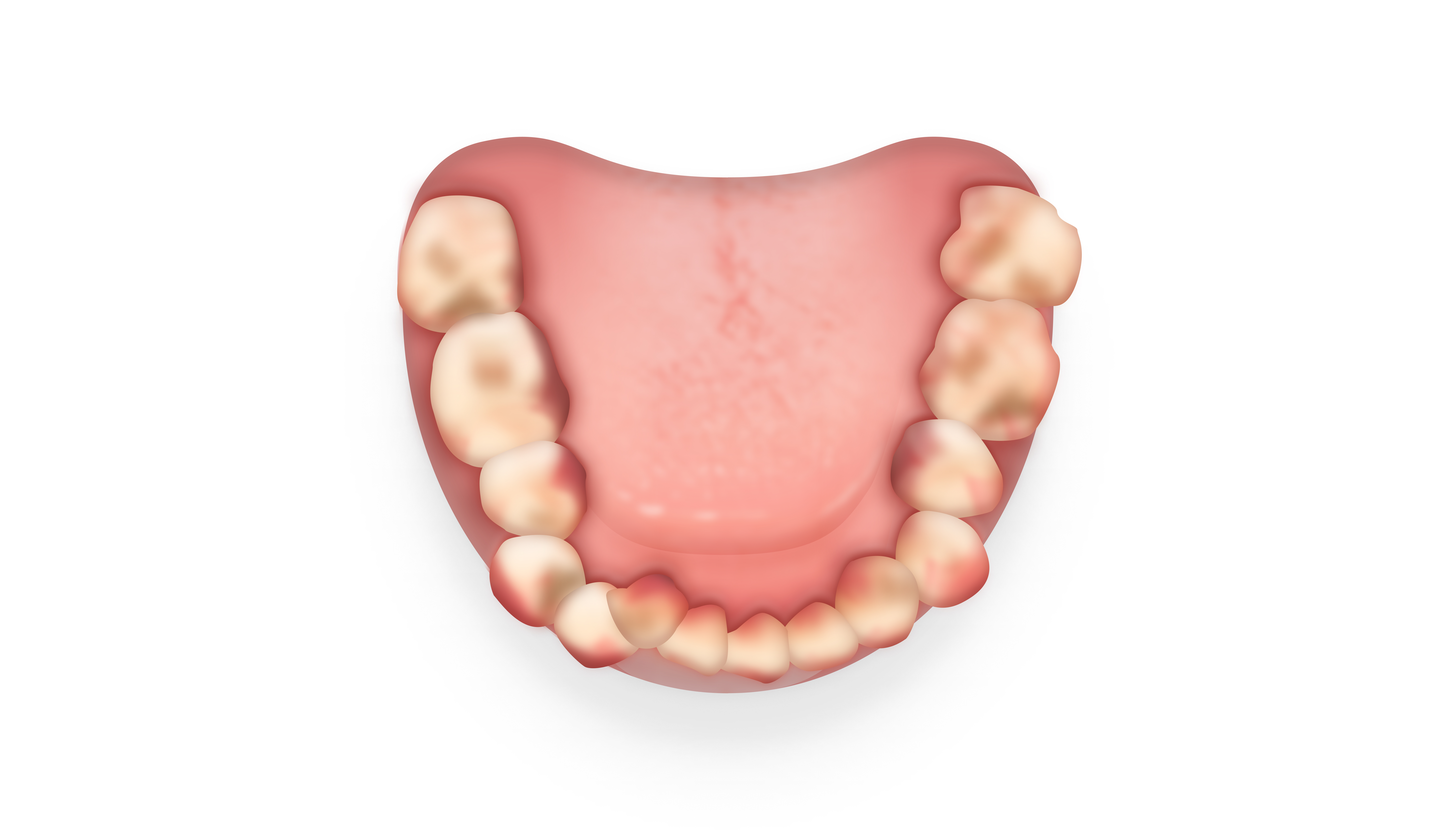 after image