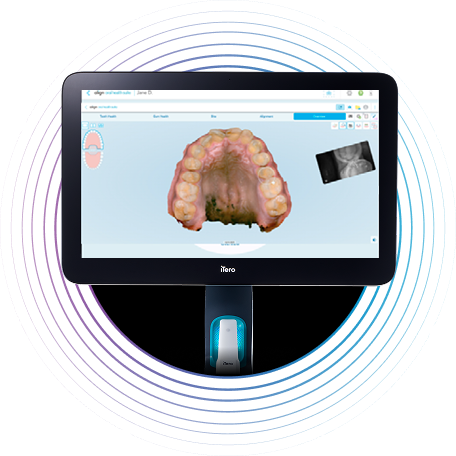 image-accordion-tooth-health