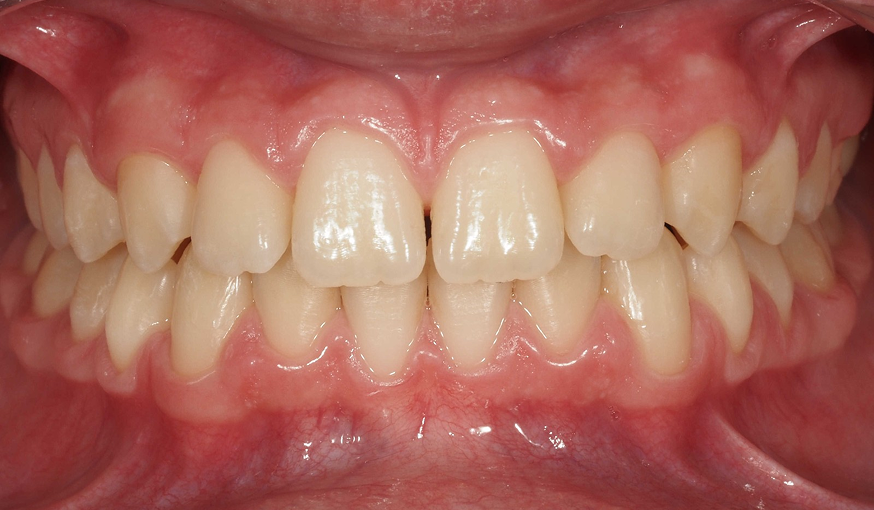 after image
