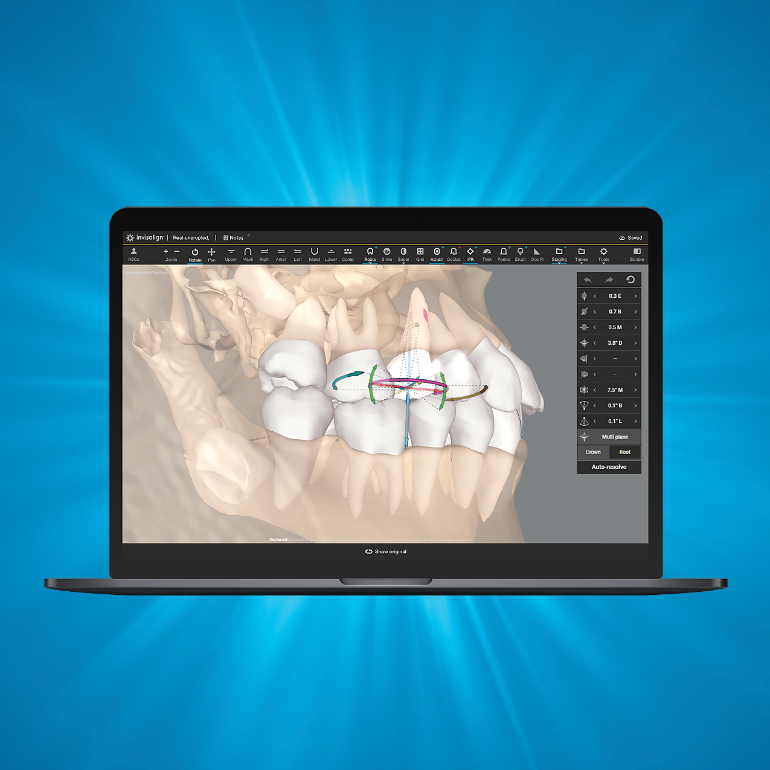 Ortho Adoption campaign > CBCT