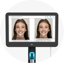 iTero scanner showing a before and after picture of a female patient