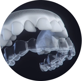 SmartTrack material fitted to teeth black background