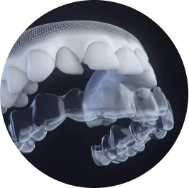 photo-3-up-smarttrack-material-fitted-to-teeth-black-background