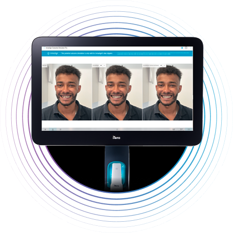 image-accordion-item-multiple-treatment-simulation