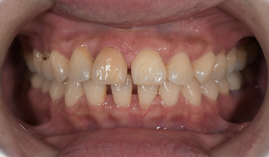 before image