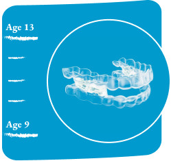 image-card-age-13-mandibular-advancement