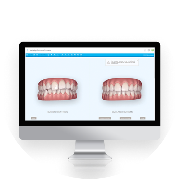 Invisalign Essentials > Proprietary ClinCheck