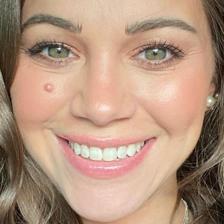 Young woman smiling after successful Invisalign® treatment