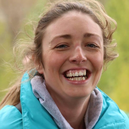Woman smiling before Invisalign® treatment